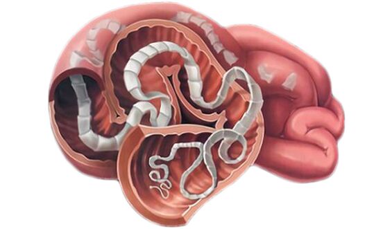 Parassiti intestinali